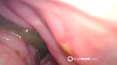 Endoscope In My Ass - Scatbook.com - Dildo, Anal [FullHD 1080p]