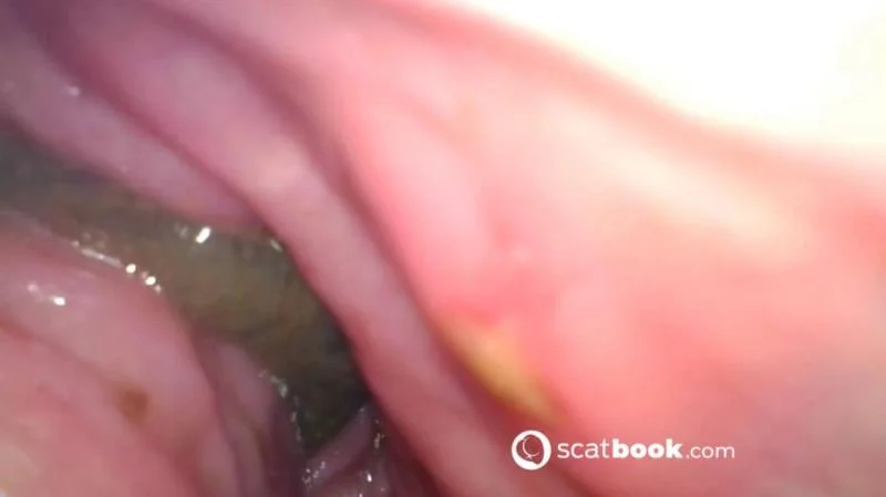 Endoscope In My Ass - Scatbook.com - Dildo, Anal [FullHD 1080p]