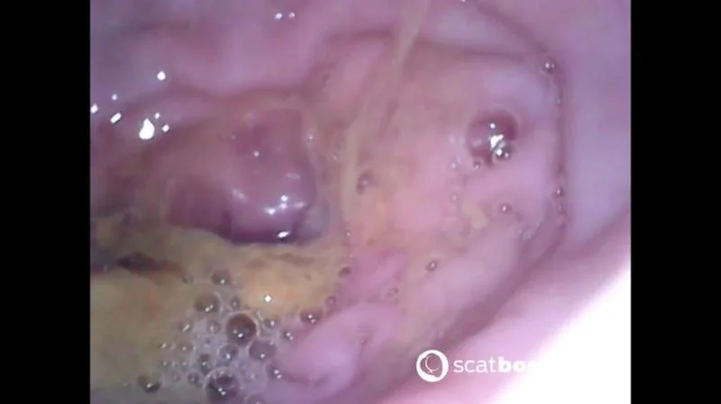 Show Inside Of My Ass With Endoscope - Scatbook.com - Dildo, Anal [FullHD 1080p]