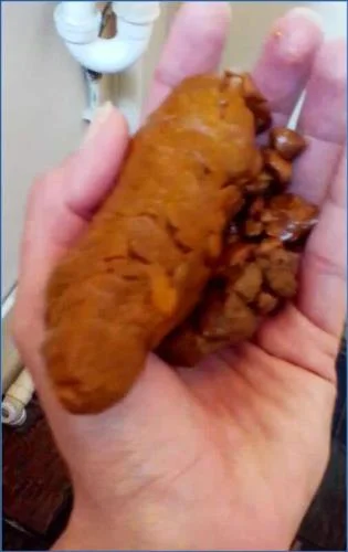 Liglee Drenches Herself in Pee and Shit - Extreme Solo Scat Action