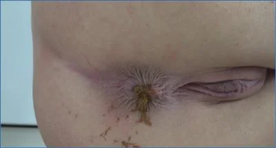 Sarah and Angie Share Their Extreme Coprophagia Fantasy